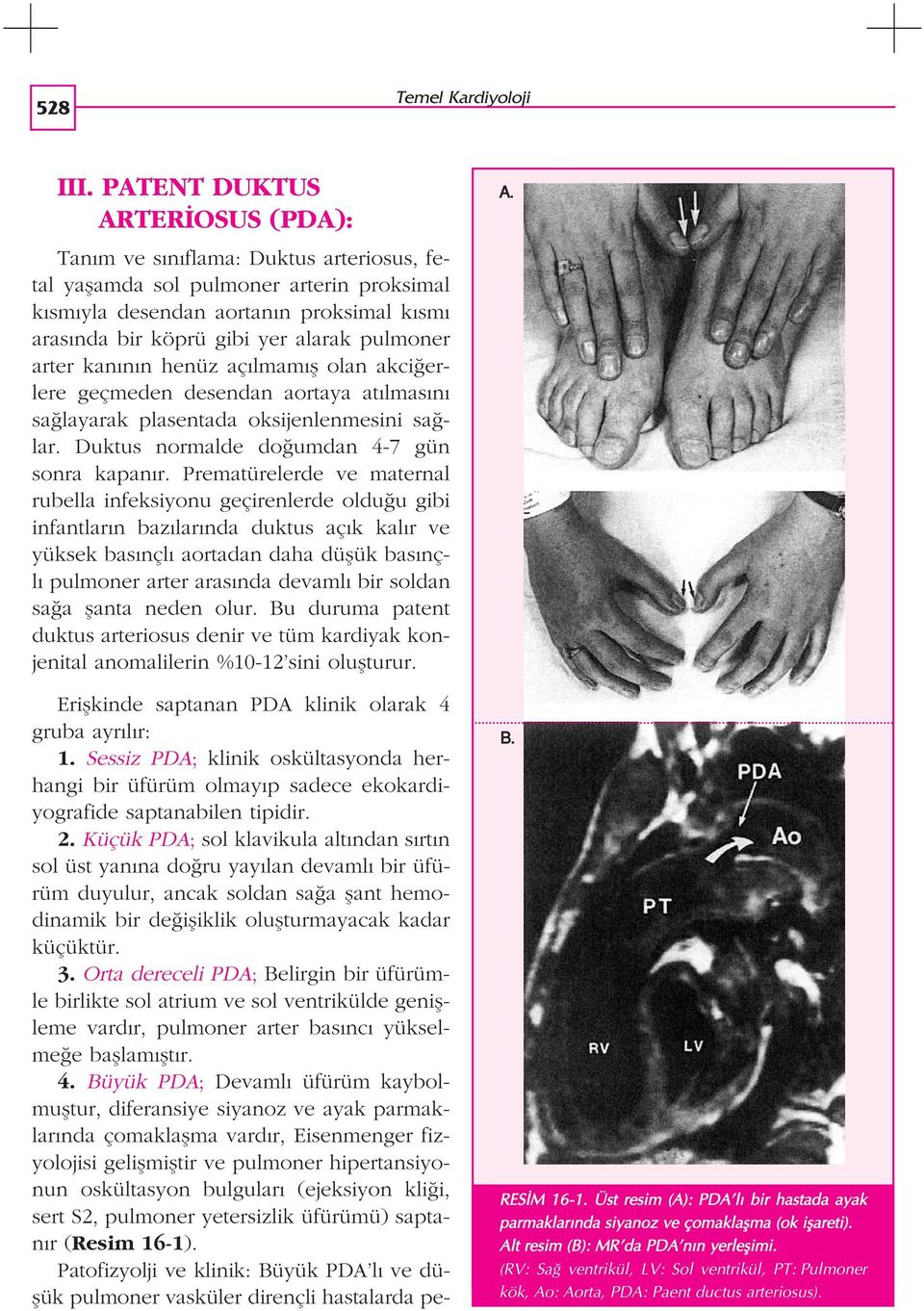 fl olan akci erlere geçmeden desendan aortaya at lmas n sa layarak plasentada oksijenlenmesini sa lar. Duktus normalde do umdan 4-7 gün sonra kapan r.