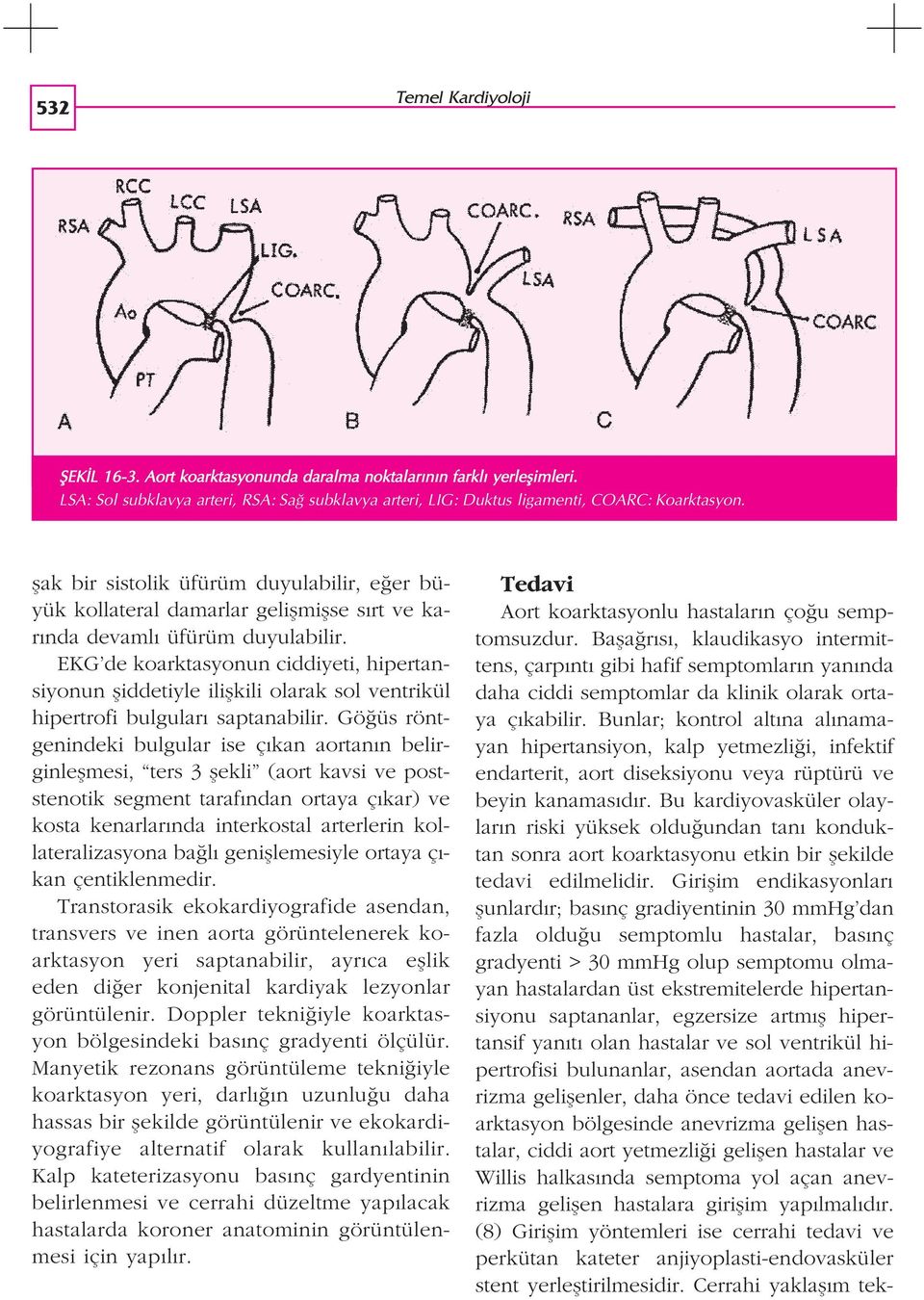 EKG de koarktasyonun ciddiyeti, hipertansiyonun fliddetiyle iliflkili olarak sol ventrikül hipertrofi bulgular saptanabilir.