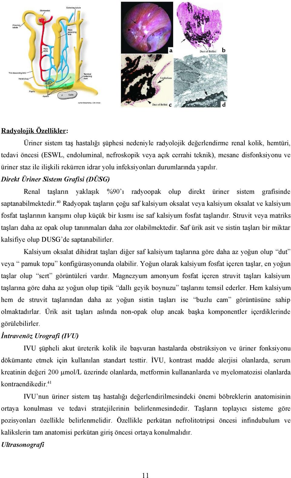 Direkt Üriner Sistem Grafisi (DÜSG) Renal taşların yaklaşık %90 ı radyoopak olup direkt üriner sistem grafisinde 40 saptanabilmektedir.