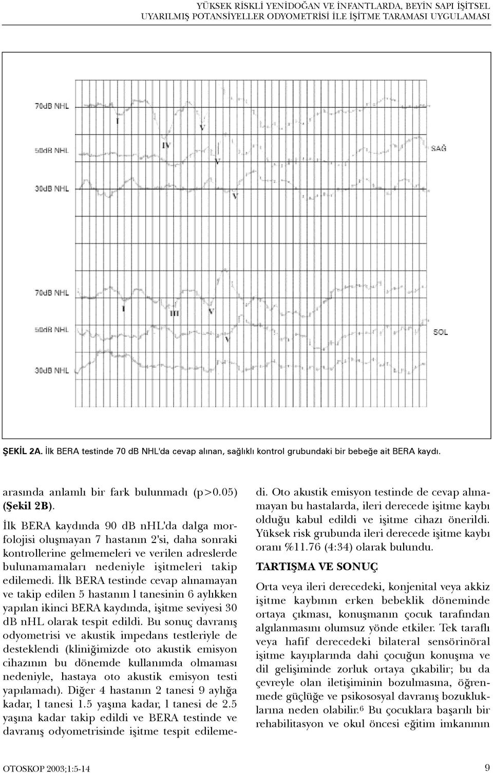 Ýlk BERA kaydýnda 90 db nhl'da dalga morfolojisi oluþmayan 7 hastanýn 2'si, daha sonraki kontrollerine gelmemeleri ve verilen adreslerde bulunamamalarý nedeniyle iþitmeleri takip edilemedi.