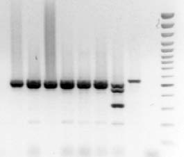 Ankara Üniversitesi Hastanesinde 2002-2005 Yılları Arasında Kan Kültürlerinden İzole Edilen Metisiline Dirençli Staphylococcus aureus Suşlarının Moleküler Özellikleri BULGULAR Çalışmaya alınan