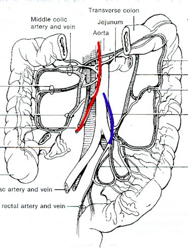 Sınıflandırma tıkanma arteriyel Tıkanma vakalarının % 70-80 i SMA trombozu, aterosklerotik zemin üzerinde