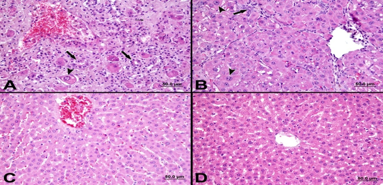 ÇİFTÇİ R. ve YÜCE A. Karaciğer Fibrozisli Ratlarda Kuersetinin Homosistein F.Ü. Sağ. Bil. Vet. Derg. Şekil 1. A. CCl 4 uygulanan grupta hepatositlerde karyomegali (ok başı), safra kanal proliferasyonları (büyük oklar), postnekrotik fibrozis (küçük ok) ve hücre infiltrasyonları, HEx20.