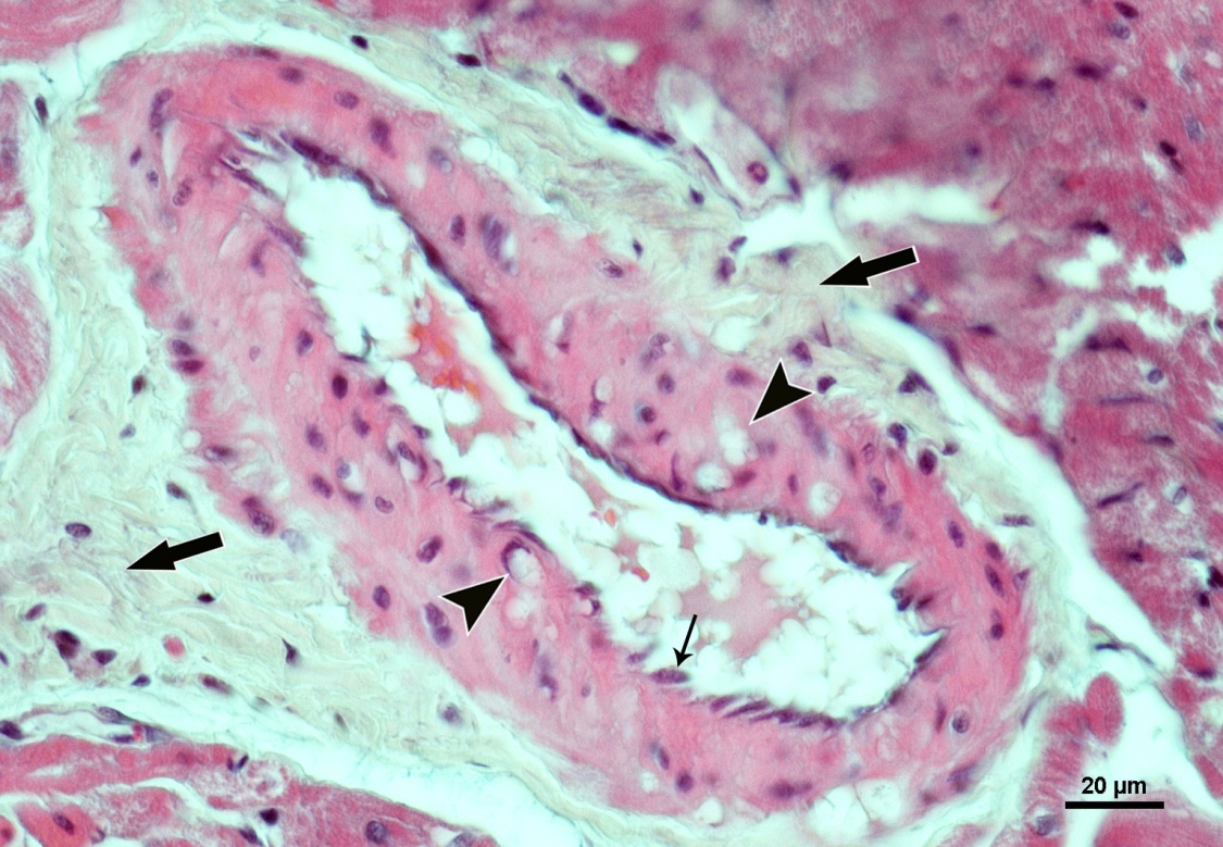 Cilt: 27, Sayı: 3 Karaciğer Fibrozisli Ratlarda Kuersetinin Homosistein Ekim 2013 Şekil 2. Kontrol grubunda koroner arterin görünümü, H-E Şekil 3.
