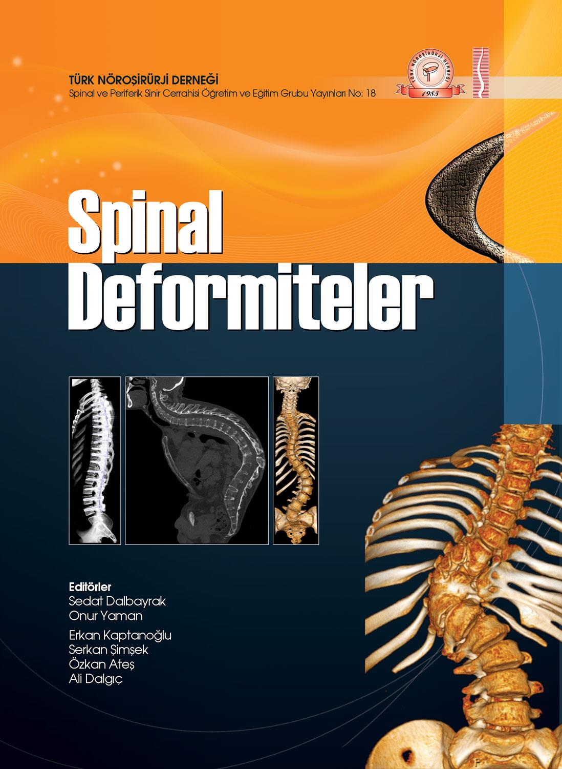 2. Spinal Deformiteler konulu sempozyumumuza bağlantılı olarak hazırlamış olduğumuz kitapla, yerli kaynak eksikliği olan deformite konusunda yararlı olabilecek basılı bir kaynak yaratmaya çalıştık.