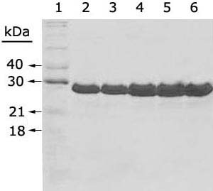 Şekil 3.1. Jel filtrasyon kolonundan elde edilen saflaştırılmış rekombinant GRA1 proteininin SDS-PAGE analizi. 1. örnek: Protein standart (QuantPro, Expression Technologies, San Diego, CA); 2 6.