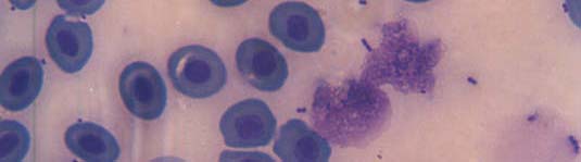 etmektedir. Levamisol uygulanan balıklardan alınan kan örneklerinde fagositik aktivite sonucu aktif hücrelerin görünümü Şekil 4.12.