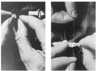 Böbrek Transplantasyonu Kronoloji 1900 Carrel Anastomoz tekniği 1933 Voronoy İlk kadavradan nakil 1954 Murray