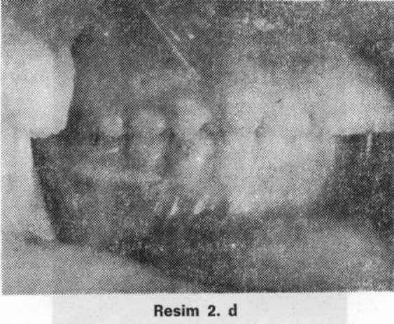 Jasper Jumper G.Ü. Dişhek. Fak. Der., 1995 Resim 2.