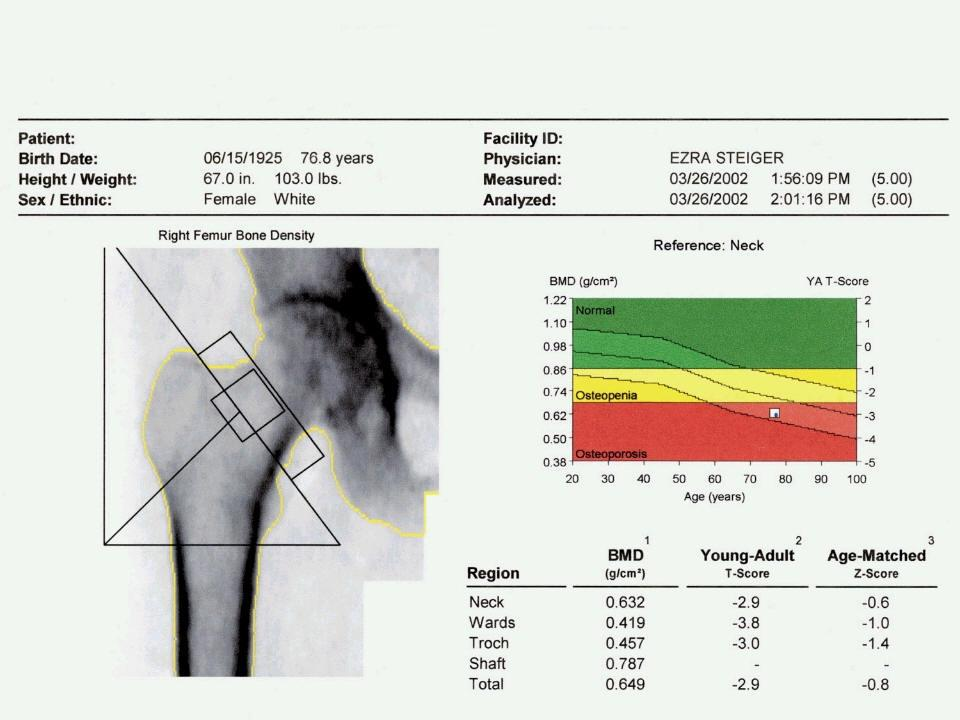 Osteoporoz TANI: Dual Enerji