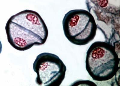 İNTERKİNEZ İki kutuptaki kromozom takımının etrafında bir nükleus zarı oluşarak iki yavru nükelus meydana gelir Mitozdaki interfaza tekabül eder fakat DNA sentezi yoktur Bundan sonra ikinci