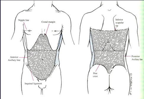 ABDOMİNAL TRAVMA Önde meme başlarından inguinal kıvrımlara, arkada skapula alt ucundan kalçada gluteal kıvrıma kadar olan bölgenin travması Sınıflandırma Künt Motorlu taşıt kazaları Darp Yüksekten