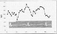 Ana Kar Der 19 Bulgular Standart ekokardiyografi indeksleri: (Tablo 1) parametrelerin karfl laflt r lmas n göstermektedir.