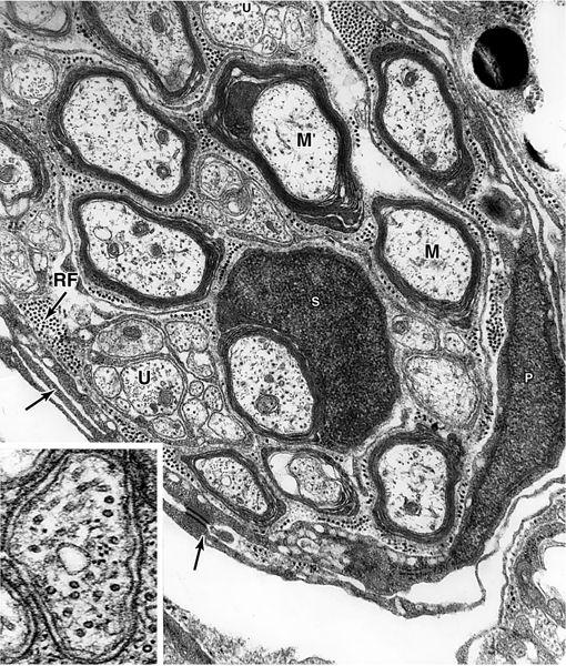 myelinated (M) and unmyelinated (U) nerve fibers. reticular fibers (RF) Schwann cell nucleus (S).
