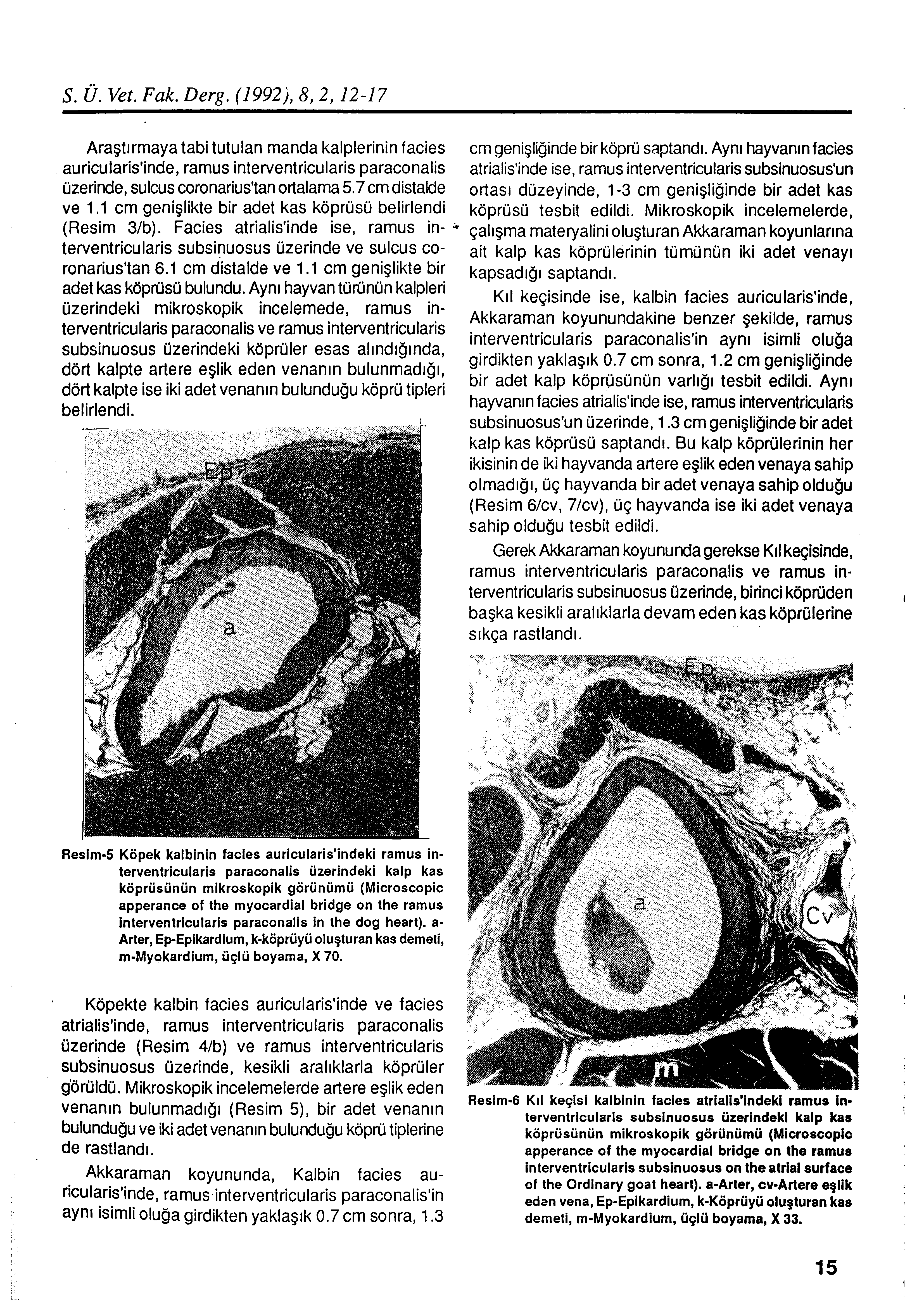 S. Ü. Vet. Fak. Derg. ( 1992j, 8, 2, 12-17 Araştırmaya tabi tutulan manda kalplerinin facies auricularis'inde, ramus interventricularis paraconalis üzerinde, sulcus coronarius'tan ortalama 5.