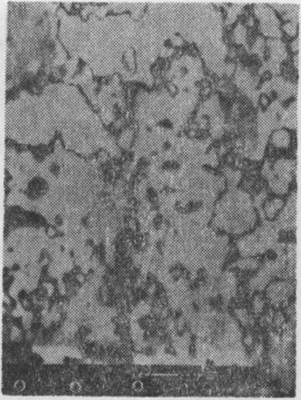 Resim la. Dispersalloy'un 3:1 arasındaki kompozisyon görüntüsü. Resim lb.