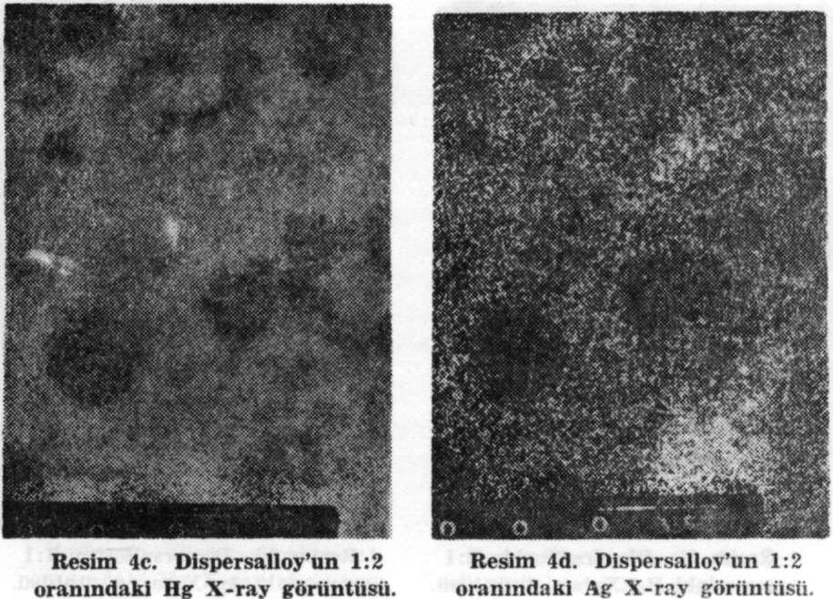 Resim 4a. Dispersalloy'un 1:2 Resim 4b.