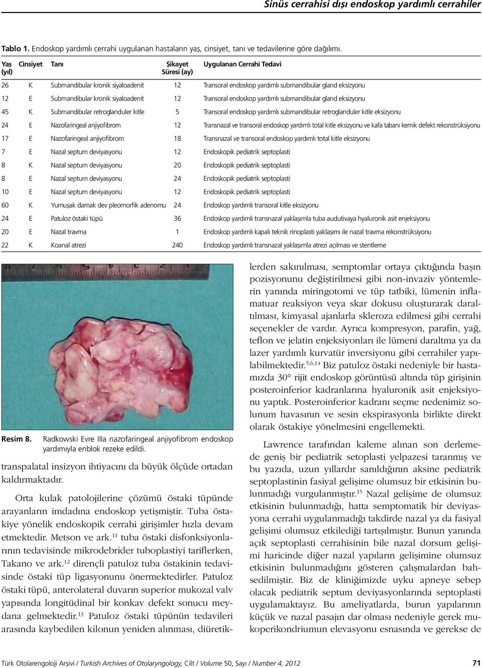 siyaloadenit 12 Transoral endoskop yardımlı submandibular gland eksizyonu 45 K Submandibular retroglanduler kitle 5 Transoral endoskop yardımlı submandibular retroglanduler kitle eksizyonu 24 E