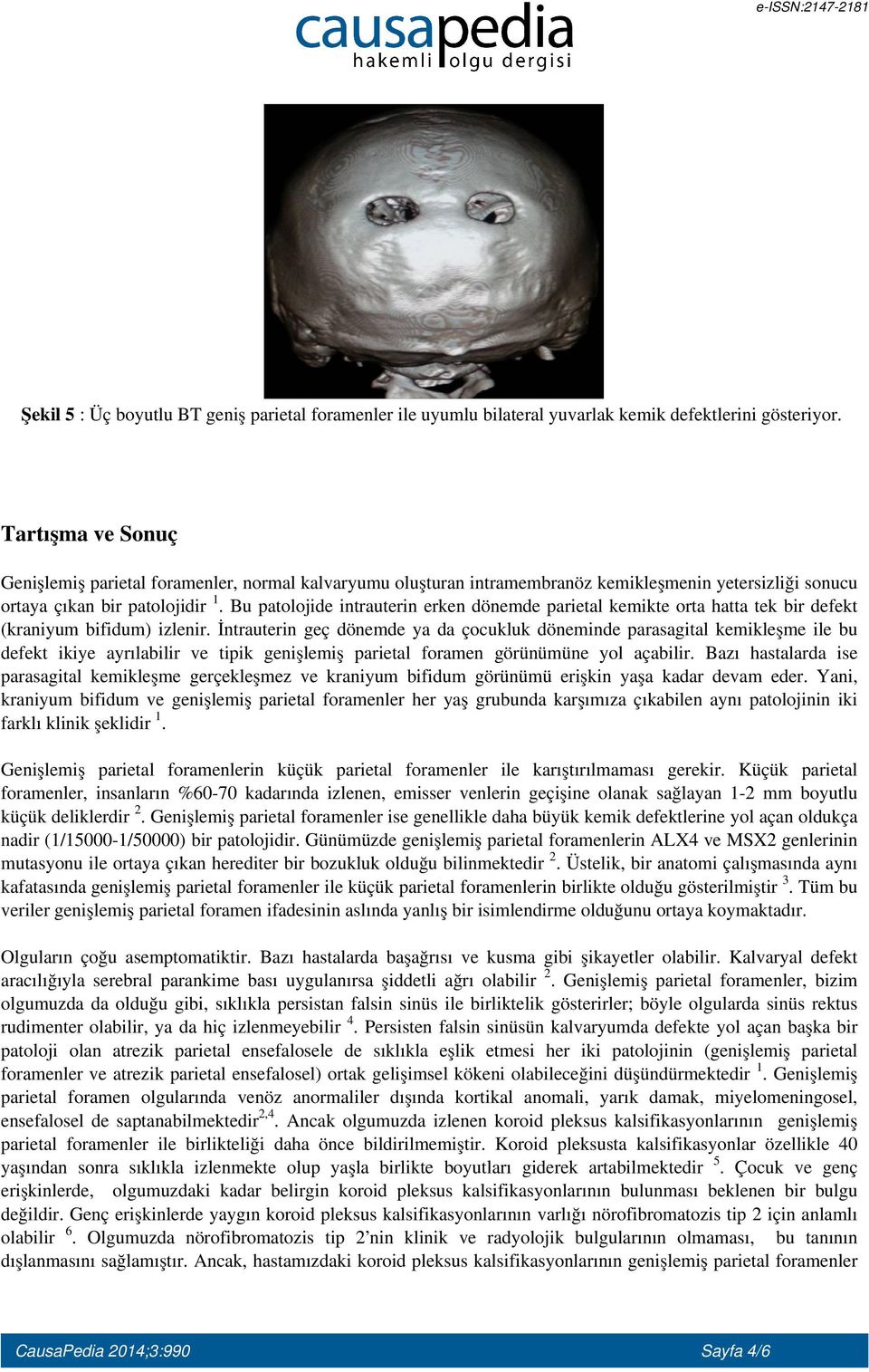 Bu patolojide intrauterin erken dönemde parietal kemikte orta hatta tek bir defekt (kraniyum bifidum) izlenir.