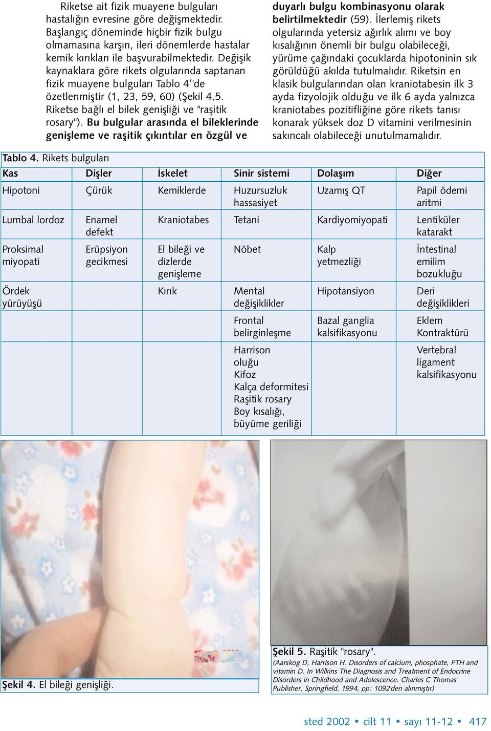 Bu bulgular arasýnda el bileklerinde geniþleme ve raþitik çýkýntýlar en özgül ve duyarlý bulgu kombinasyonu olarak belirtilmektedir (59).