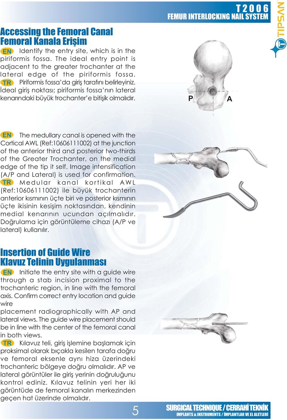 Ýdeal giriþ noktasý; piriformis fossa nýn lateral kenarýndaki büyük trochanter e bitiþik olmalýdýr.