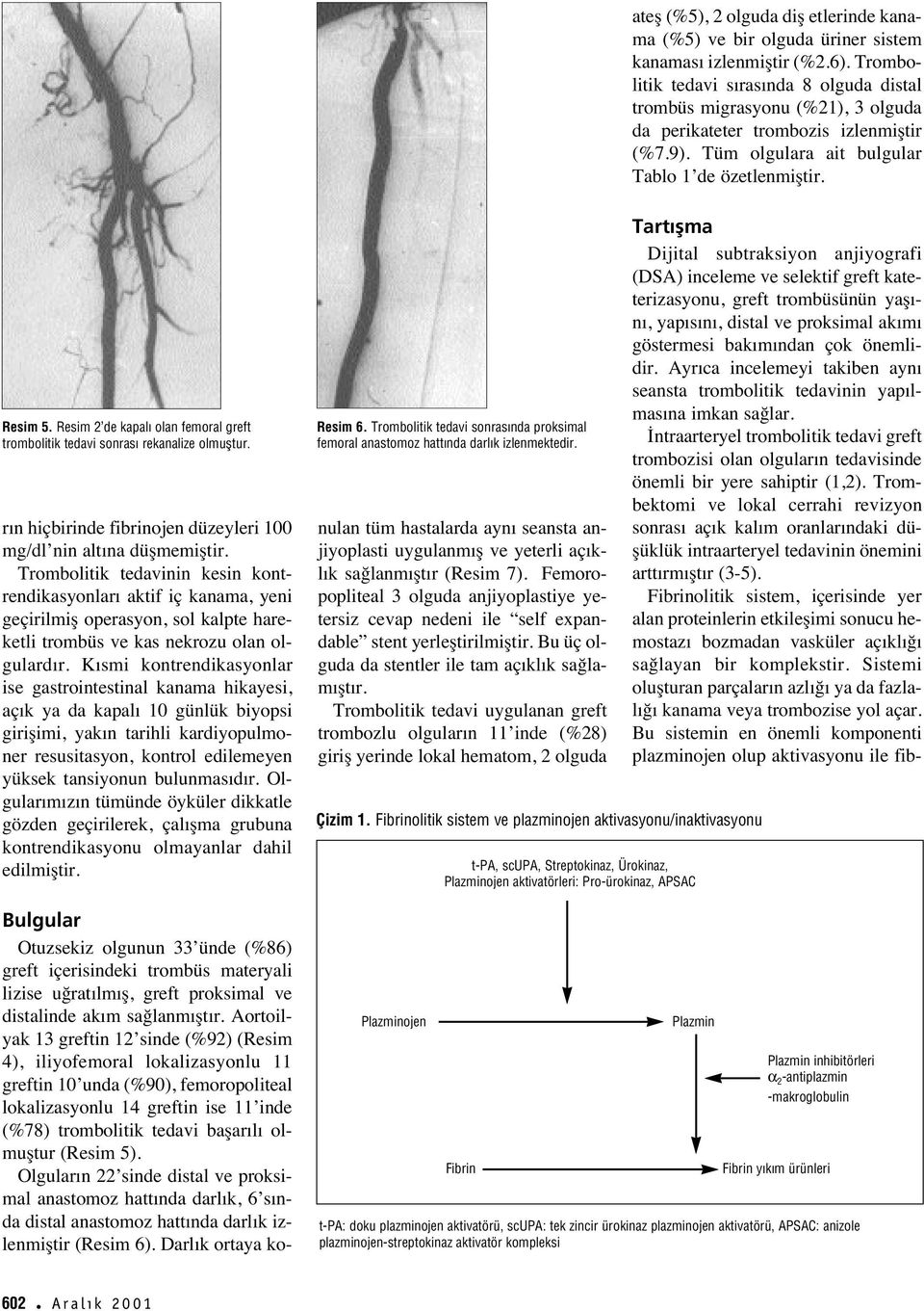 Resim 2 de kapal olan femoral greft trombolitik tedavi sonras rekanalize olmufltur. r n hiçbirinde fibrinojen düzeyleri 100 mg/dl nin alt na düşmemiştir.