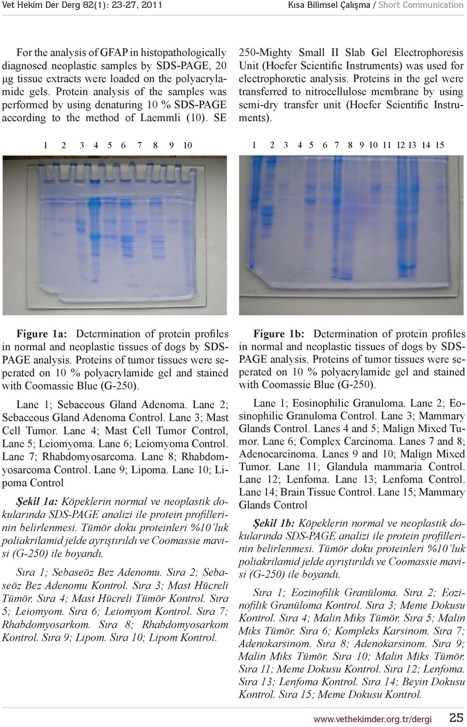 SE 1 2 3 4 5 6 7 8 9 10 250-Mighty Small II Slab Gel Electrophoresis Unit (Hoefer Scientific Instruments) was used for electrophoretic analysis.