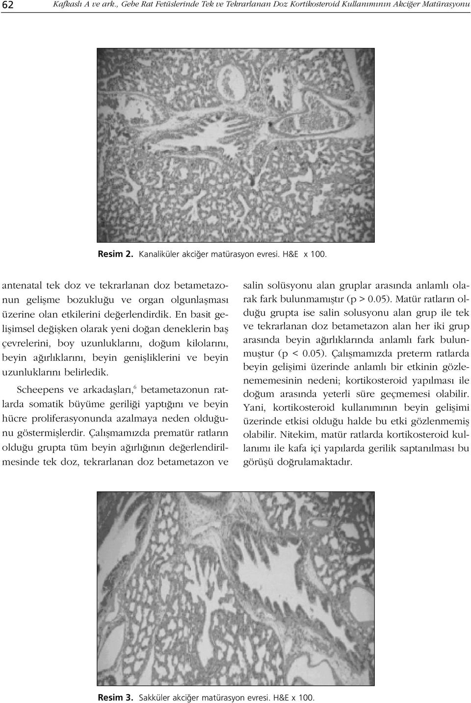 En basit geliflimsel de iflken olarak yeni do an deneklerin bafl çevrelerini, boy uzunluklar n, do um kilolar n, beyin a rl klar n, beyin geniflliklerini ve beyin uzunluklar n belirledik.