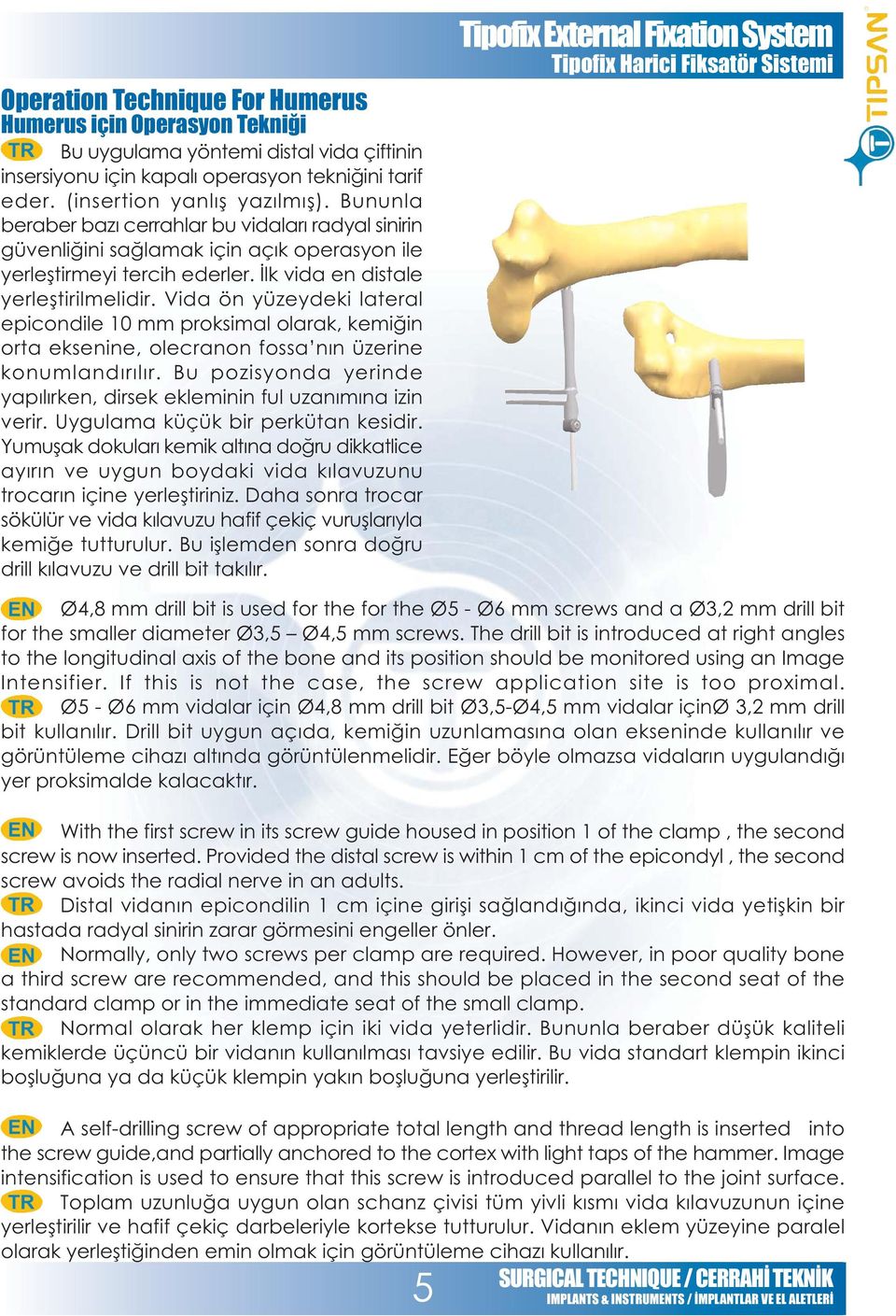 Vida ön yüzeydeki lateral epicondile 10 mm proksimal olarak, kemiðin orta eksenine, olecranon fossa nýn üzerine konumlandýrýlýr.