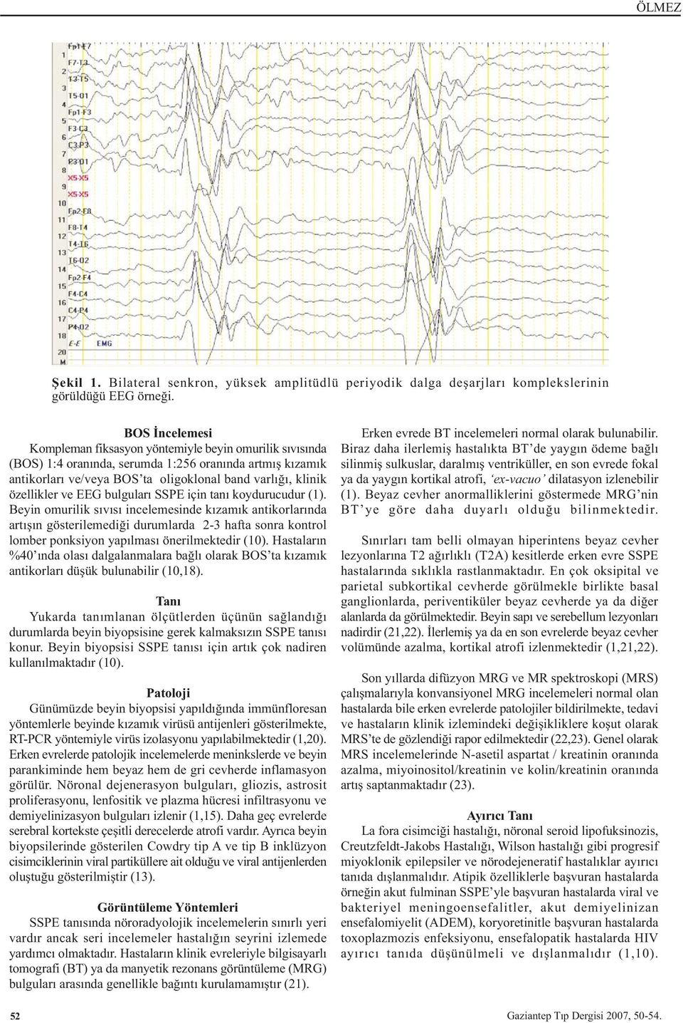 ve EEG bulgularý SSPE için taný koydurucudur (1).