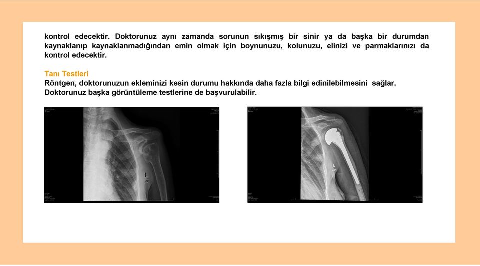 kaynaklanmadığından emin olmak için boynunuzu, kolunuzu, elinizi ve parmaklarınızı da  Tanı