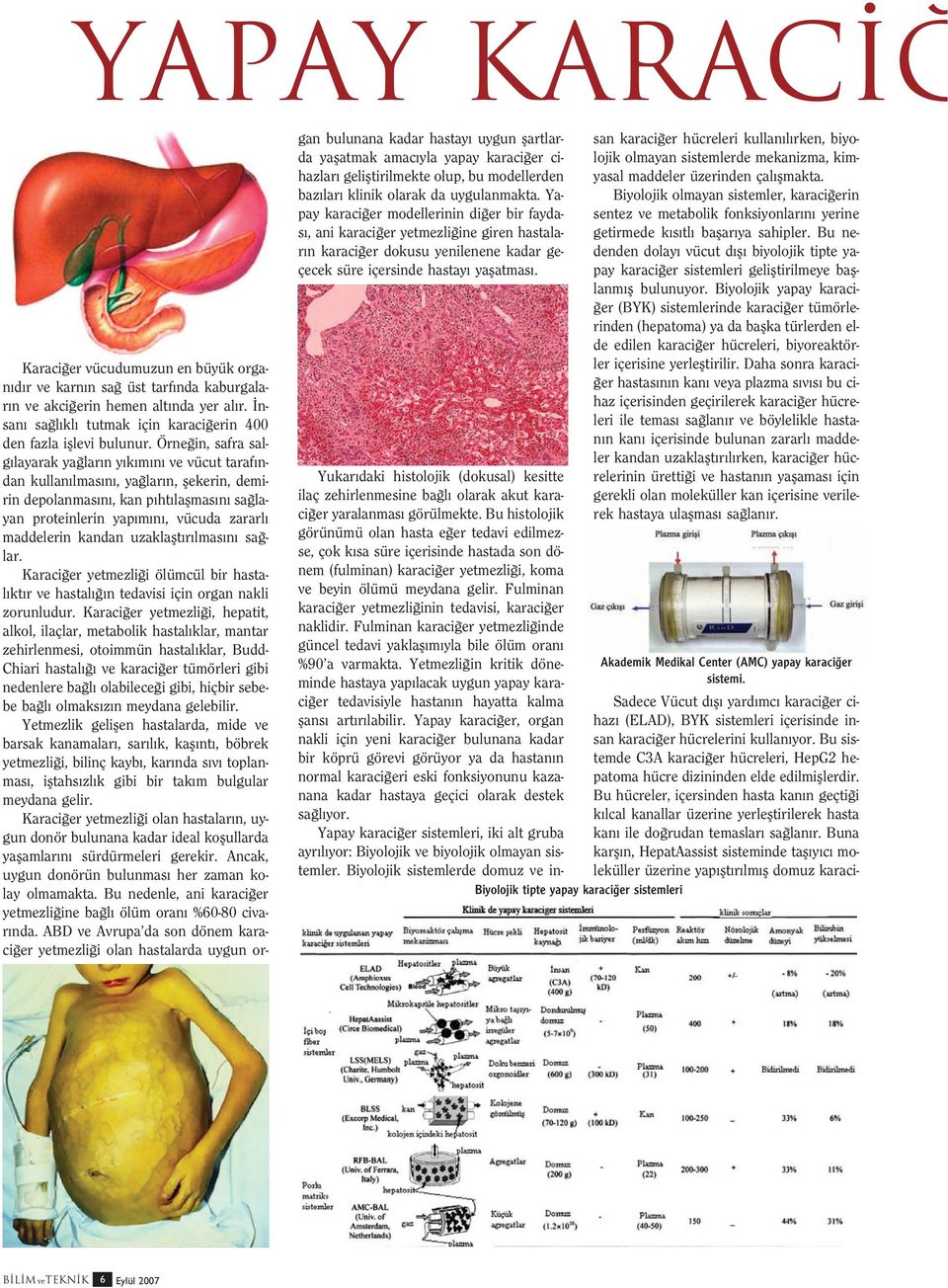 kandan uzaklaflt r lmas n sa lar. Karaci er yetmezli i ölümcül bir hastal kt r ve hastal n tedavisi için organ nakli zorunludur.