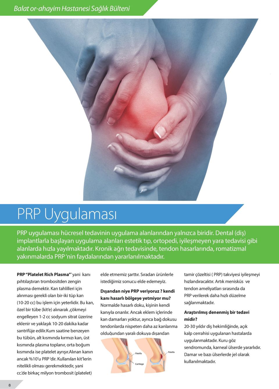 Kronik ağrı tedavisinde, tendon hasarlarında, romatizmal yakınmalarda PRP nin faydalarından yararlanılmaktadır. PRP Platelet Rich Plasma yani kanı pıhtılaştıran trombositden zengin plasma demektir.