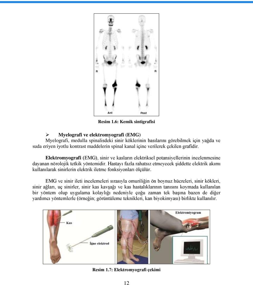 içine verilerek çekilen grafidir. Elektromyografi (EMG), sinir ve kasların elektriksel potansiyellerinin incelenmesine dayanan nörolojik tetkik yöntemidir.