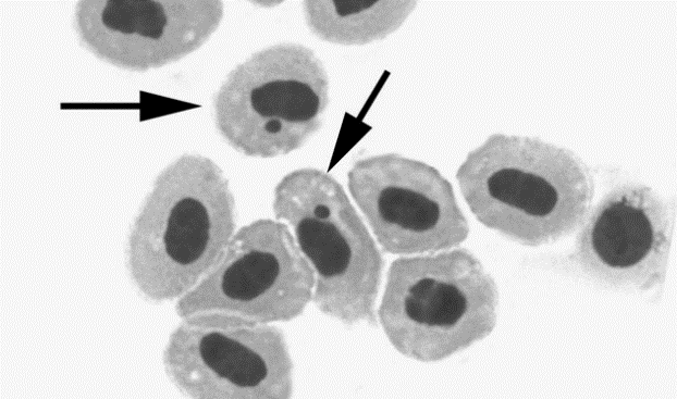 70 Genotoksik etki göstermektedir. Araştırma sonuçlarından metil civanın C.