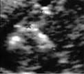 Perinatoloji Dergisi Cilt: 14, Say : 3/Eylül 2006 123 Girifl Gebeli in 9-24 haftalar aras nda radyografik ve histolojik olarak yap lan araflt rmada ilk kemikleflme noktalar CRL 42 mm iken görüldü ü