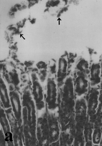 Şekil 2c. Açlık grubuna ait kesit. Apoptotik görünümlü hücreler (ok) izlenmekte H&E X 100.