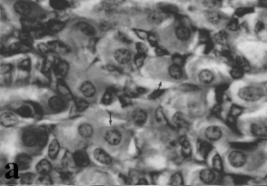Submukozadaki ve bezlerin bazal bölgesindeki eozinofilik boyanan hücre artışı devam etmekteydi (Şekil 6a).