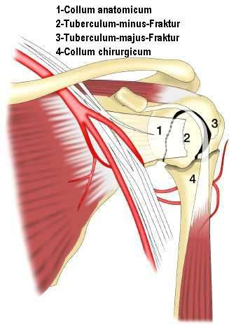 Tuberculum Minus