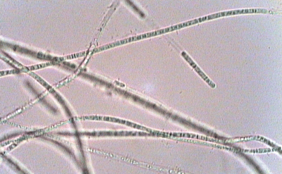 Siyanobakteriler 5 gruba ayrılır (Ripkka 1988b); 1) Tek hücreli ikiye bölünerek çoğalan siyanobakteriler 2) Tek hücreli çok tipli bölünerek çoğalan siyanobakteriler 3) Flamentli heterosist