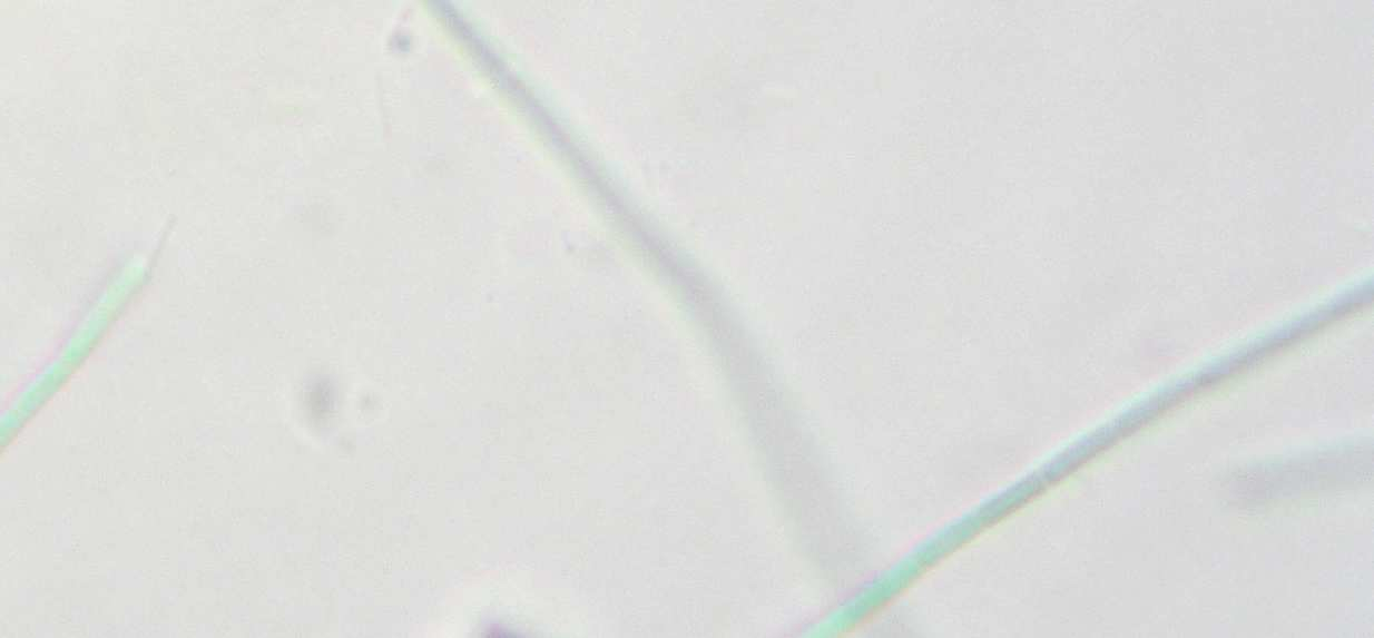 10µm Şekil 5.1 Phormidium sp. nin hücre yapısı (Sadettin, 2005) 5.2 Phormidium sp.