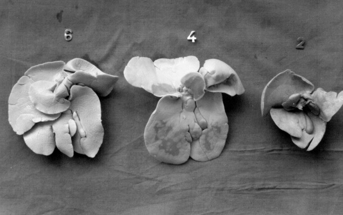 4 Rectum un, colon descendens in cavum pelvis içerisindeki uzantısı olduğu tespit edildi. Proc.