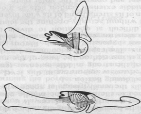 Şekil 7. Art. interphalangea proximalis: Orta falanks bazis inde iki glenoid kavite. 43 Şekil 8. Art. interphalangea proximalis: Fleksiyonda ve ekstansiyonda kollateral bağların gergin hali.