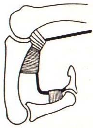 2. 2. Fonksiyonel Anatomi 2. 2. 1. Fleksiyonun Motor Gücü Temel güç m.flexor digitorum profundus tur. Bu kas 2.-5.