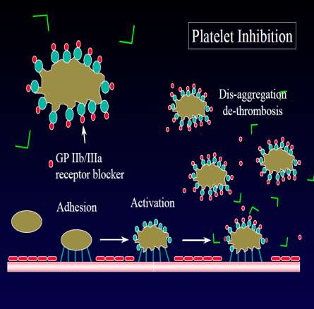 Klopidogrel Thienopyridinlerin özellikle clopidogrel, ticlopidin ve glycoprotein IIb/IIIa inhibitörlerinin kullanımı son