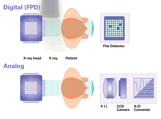 Flat Panel Dedektör Yeni Nesil CMOS Sintilatörlü