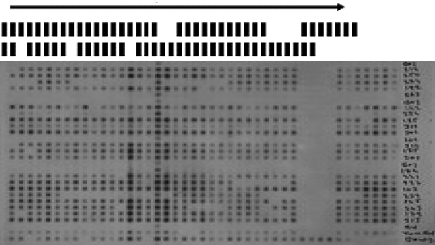 Mycobacterium bovis BCG Suşunun Neden Olduğu Fatal Disemine Enfeksiyon Olgusu ve İzolatın Spoligotiplendirme ile Tanımlanması 1 Spacers 43 H37Rv BCG Resim 1.