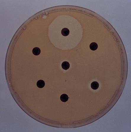 Gönüllü N, Gürol Y, Bülüç M, Bal Ç. Pseudomonas aeruginosa Sufllar nda Görülen Beta-Laktam G R fi Pseudomonas aeruginosa, en önemli hastane infeksiyonu etkenlerinden biridir.