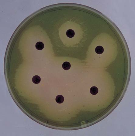 Gönüllü N, Gürol Y, Bülüç M, Bal Ç. Pseudomonas aeruginosa Sufllar nda Görülen Beta-Laktam Resim 7. Duyarl Fenotip.