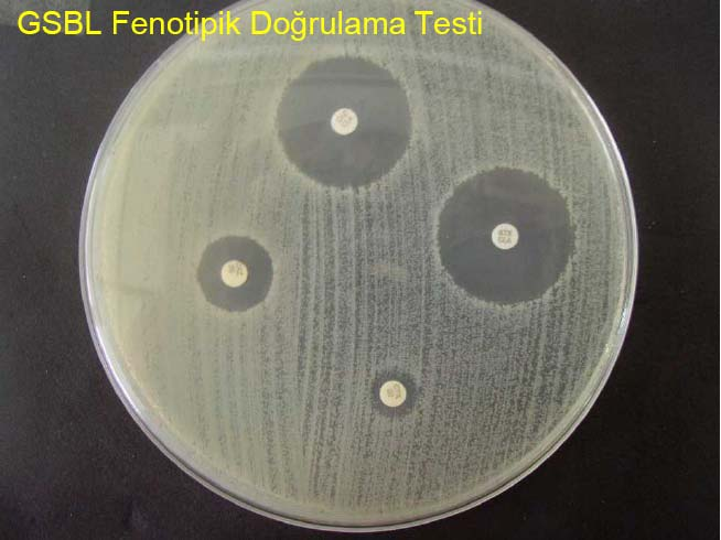 Kombine Disk Yöntemi Kombine Disk Yöntemi, GSBL Doğrulama Testi Sefotaksim (30 µg)